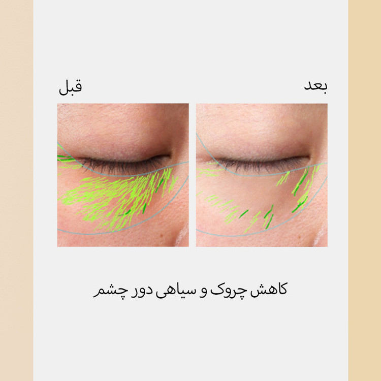 دستگاه جوانسازی کی دی کی مدل سه در یک